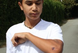 The 15-year-old has a scape on his right hand, a large scrape on his left elbow and arm, a hyper-extended left leg and has a lot of muscle soreness.